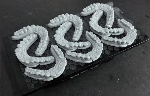 D1 dental model print